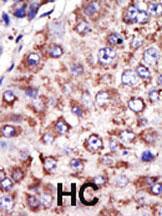 Anti-FDFT1 Rabbit Polyclonal Antibody (PE (Phycoerythrin))