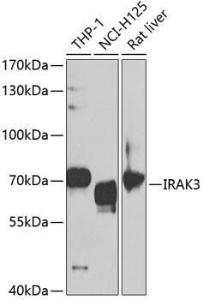 Anti-IRAKM antibody