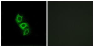 Anti-APOL5 antibody