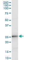 Anti-BCAP29 Rabbit Polyclonal Antibody