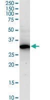 Anti-RPRD1A Polyclonal Antibody Pair