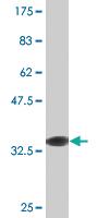 Anti-RFC4 Mouse Monoclonal Antibody [clone: 1B2]