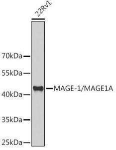 Western blot analysis of extracts of 22Rv1 cells, using Anti-MAGEA1 Antibody (A11838) at 1:1,000 dilution