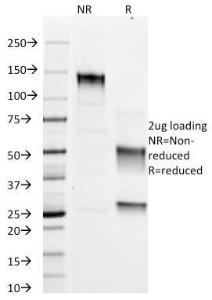 SDS-PAGE analysis of Anti-Adipophilin Antibody [ADFP/1366] under non-reduced and reduced conditions; showing intact IgG and intact heavy and light chains, respectively. SDS-PAGE analysis confirms the integrity and purity of the antibody