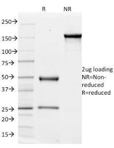 Anti-Integrin alpha V antibody