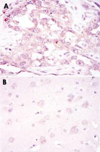 Anti-PRKAA1 Mouse Monoclonal Antibody [clone: 2B7]