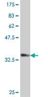 Anti-SOD3 Mouse Polyclonal Antibody