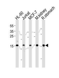 Anti-NME2 Rabbit Polyclonal Antibody (AP (Alkaline Phosphatase))