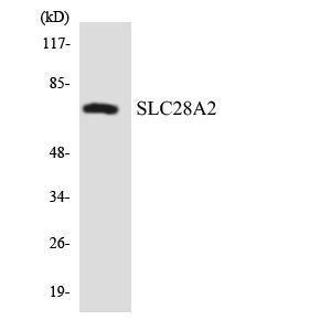 Western blot analysis of the lysates from HepG2 cells using Anti-SLC28A2 Antibody