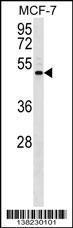 Anti-ENPP5 Rabbit Polyclonal Antibody (Biotin)