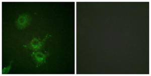 Immunofluorescence analysis of HUVEC cells using Anti-EGFR (phospho Thr693) Antibody. The right hand panel represents a negative control, where the Antibody was pre-incubated with the immunising peptide