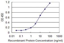 Anti-SEPHS1 Mouse Monoclonal Antibody [clone: 4D3-6A2]