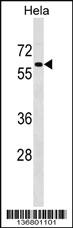 Anti-PAF1 Rabbit Polyclonal Antibody