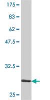 Anti-CLDN5 Mouse Polyclonal Antibody