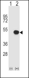 Anti-HLA Class 1 Antigen B Rabbit Polyclonal Antibody