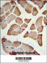 Anti-LFNG Rabbit Polyclonal Antibody (FITC (Fluorescein Isothiocyanate))