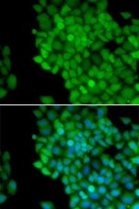 Immunofluorescence analysis of HeLa cells using Anti-MAGEA1 Antibody (A11838). DAPI was used to stain the cell nuclei (blue)