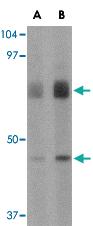 Anti-DHX58 Rabbit Polyclonal Antibody