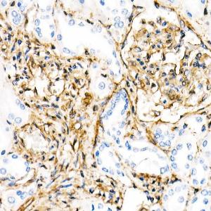 Immunohistochemistry analysis of paraffin-embedded human kidney using Anti-Vimentin Antibody [ARC0086] (A305554) at a dilution of 1:50(40X lens). Perform microwave antigen retrieval with 10 mM PBS buffer pH 7.2 before commencing with IHC staining protocol