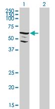 Anti-STKLD1 Mouse Polyclonal Antibody