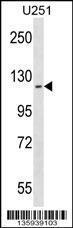 Anti-ATP13A2 Rabbit Polyclonal Antibody (AP (Alkaline Phosphatase))