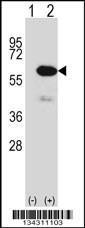 Anti-METAP2 Rabbit Polyclonal Antibody (AP (Alkaline Phosphatase))