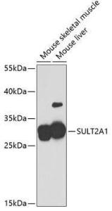 Western blot analysis of extracts of various cell lines, using Anti-SULT2A1/ST2 Antibody (A11841) at 1:2,000 dilution The secondary antibody was Goat Anti-Rabbit IgG H&L Antibody (HRP) at 1:10,000 dilution Lysates/proteins were present at 25 µg per lane