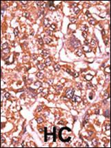 Anti-RB1 Rabbit Polyclonal Antibody (FITC (Fluorescein))