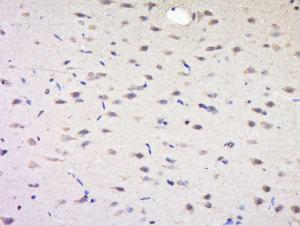 Formalin-fixed and paraffin embedded Rat Brain tissue labeled with SYNPR/Synaptoporin Polyclonal Antibody (bs-11367R) at 1:200, followed by conjugation to the seconary antibody and DAB staining