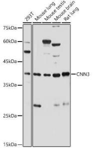 Western blot analysis of extracts of various cell lines, using Anti-Calponin 3 Antibody (A306521) at 1:500 dilution The secondary antibody was Goat Anti-Rabbit IgG H&L Antibody (HRP) at 1:10,000 dilution Lysates/proteins were present at 25 µg per lane