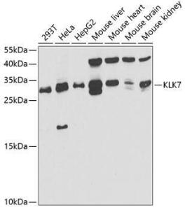 Anti-Kallikrein 7/KLK7 Rabbit Polyclonal Antibody