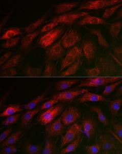 Immunofluorescence analysis of NIH/3T3 cells using Anti-Calponin 3 Antibody (A306521) at a dilution of 1:50 (40x lens) DAPI was used to stain the cell nuclei (blue)