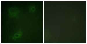 Immunofluorescence analysis of COS7 cells using Anti-IRS-1 Antibody. The right hand panel represents a negative control, where the antibody was pre-incubated with the immunising peptide.