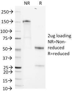 SDS-PAGE analysis of Anti-CD1b Antibody [RIV12] under non-reduced and reduced conditions; showing intact IgG and intact heavy and light chains, respectively. SDS-PAGE analysis confirms the integrity and purity of the antibody.