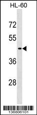 Anti-EIF2B3 Rabbit Polyclonal Antibody