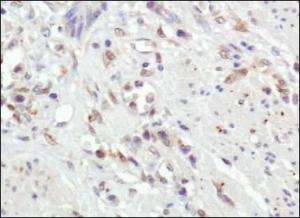 Anti-SUV420H1 Rabbit Polyclonal Antibody (DyLight® 550)