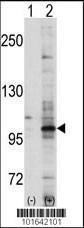 Anti-EPHA7 Rabbit Polyclonal Antibody (FITC (Fluorescein Isothiocyanate))