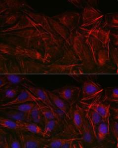 Immunofluorescence analysis of U2OS cells using Anti-Calponin 3 Antibody (A306521) at a dilution of 1:50 (40x lens) DAPI was used to stain the cell nuclei (blue)