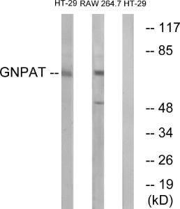 Western blot analysis of lysates from HT-29 and RAW264.7 cells using Anti-GNPAT Antibody. The right hand lane represents a negative control, where the antibody is blocked by the immunising peptide