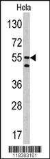 Anti-PNKD Rabbit Polyclonal Antibody