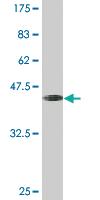 Anti-CK MB (CK-MB) Mouse Monoclonal Antibody [clone: 1F1]