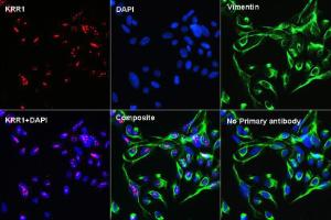 Confocal immunofluorescence analysis of U-2 OS cells using Anti-KRR1 Antibody at a dilution of 1:100 (40X lens) (red) and Anti-Vimentin Antibody [ARC0086] (A305554) for cytoskeleton staining (green). DAPI was used to stain the cell nuclei (blue)