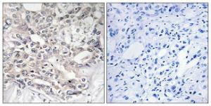 Anti-APOL5 antibody