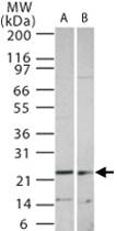 Anti-SOCS1 Rabbit Polyclonal Antibody