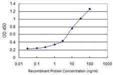 Anti-STKLD1 Mouse Monoclonal Antibody [clone: 3G3]