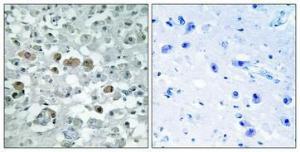 Immunohistochemical analysis of paraffin-embedded human brain using Anti-GNPAT Antibody 1:100 (4 °C overnight). The right hand panel represents a negative control, where the antibody was pre-incubated with the immunising peptide