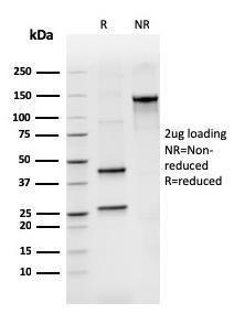 SDS-PAGE analysis of Anti-Bcl2L2 Antibody [CPTC-BCL2L2-2] under non-reduced and reduced conditions; showing intact IgG and intact heavy and light chains, respectively. SDS-PAGE analysis confirms the integrity and purity of the antibody.