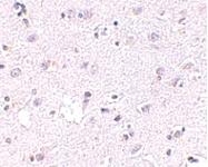 Anti-CERS5 Rabbit Polyclonal Antibody