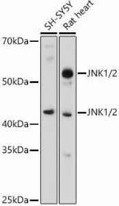 Western blot analysis of extracts of various cell lines, using Anti-JNK1 + JNK2 Antibody (A307935) at 1:500 dilution. The secondary antibody was Goat Anti-Rabbit IgG H&L Antibody (HRP) at 1:10,000 dilution.