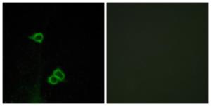 Immunofluorescence analysis of COS7 cells using Anti-CXCR7 Antibody. The right hand panel represents a negative control, where the Antibody was pre-incubated with the immunising peptide